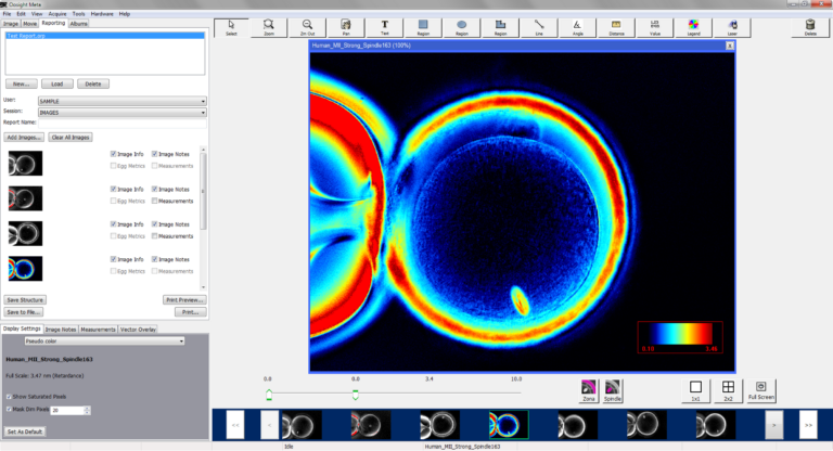 Oosight™ Imaging System