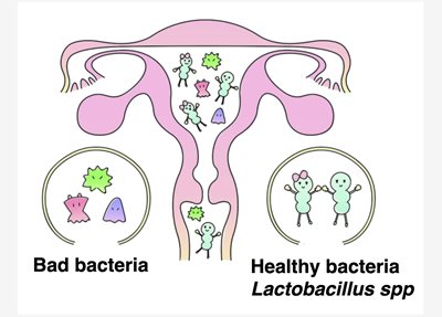 子宮內膜微生物組測試